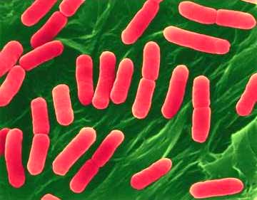 Escherichia Coli เชื้ออีโคไล การแพร่กระจายของเชื้ออีโคไล O157:H7