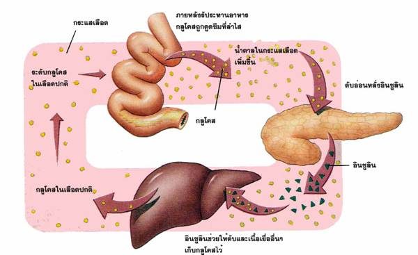 โรคอ้วนลงพุง ร่างกายดื้อต่ออินซูลิน